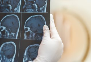 МРТ головного мозга + ангиография артерий и вен 7000руб!
