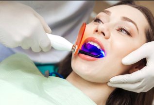 Скидка на лазерное отбеливание зубов при лечении в клинике!