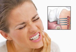 Лечение гиперчувствительности зубов - скидка 50%
