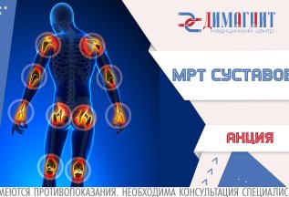 Акция на МРТ суставов до конца весны!