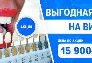 Скидка 20% на Виниры
