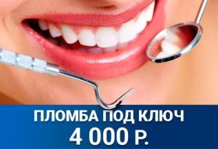 Пломба под ключ за 4000 рублей
