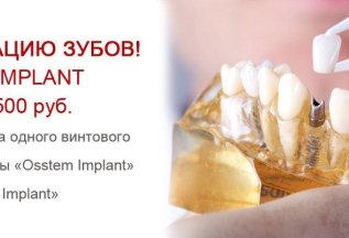 Акция на имплантацию зубов! Cистема Osstem Implant