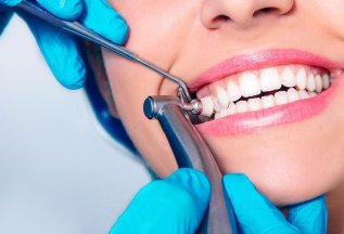Специальная цена на чистку зубов для пациентов, посещающих г