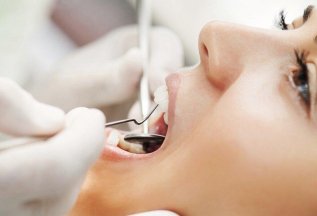 Удаление зубных отложений и пигментного налета ультразвуком