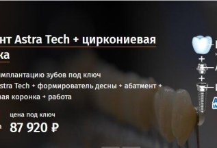 Акция на имплантацию зубов Astra Tech под ключ за 87 920 руб
