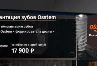 Установка импланта под ключ OSSTEM за 17 900 руб!