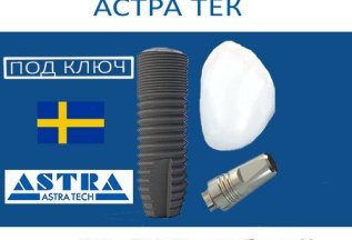 Шведские импланты Astra Tech под ключ с циркониевой коронкой