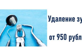 удаление зуба от 950 рублей