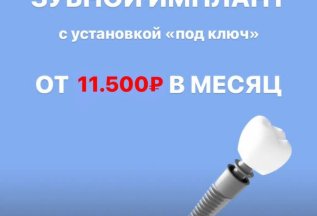 Зубной имплант с установкой под ключ.