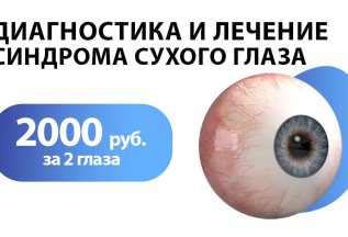 Диагностика и лечение синдрома сухого глаза