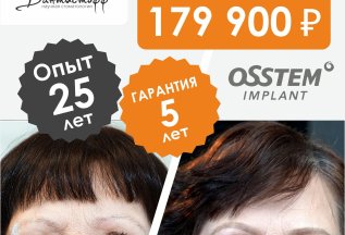 Полное протезирование за один день 179 900 рублей!