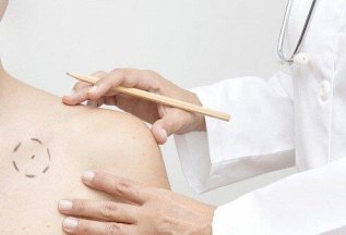 Бесплатная консультация дерматолога