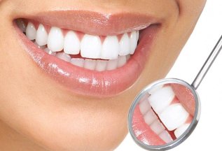 Отбеливание зубов системой Amazing white всего 10000 рублей