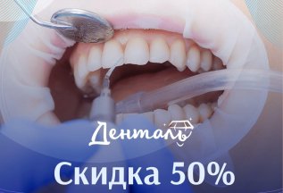 Комплексная чистка зубов - скидка 50%