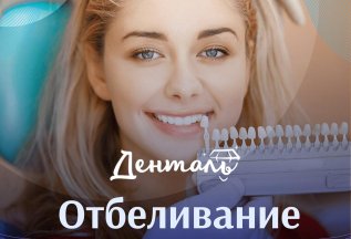 Отбеливание зубов всего за 22000 рублей - настоящий подарок!