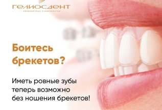 Ровные зубы без брекетов! Скидка 25%