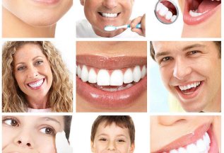 Отбеливание зубов в Альфа Стом