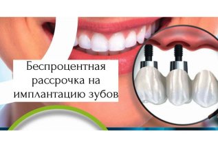 Беспроцентная рассрочка на имплантацию зубов