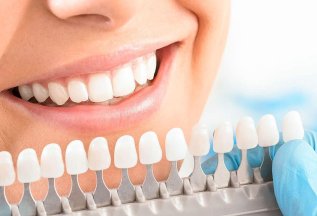 Профессиональное отбеливание зубов Amazing White