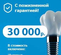 Установка имплантов за 30 000 руб. в Подольске