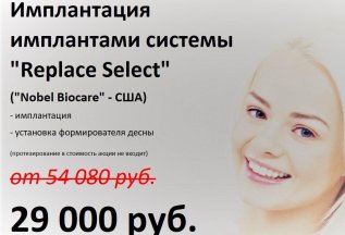 Имплантация 
