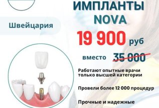 Импланты Nova  19 900 вместо 35 000