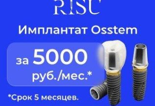 Импланты OSSTEM за 5000 руб./мес. + подарок!
