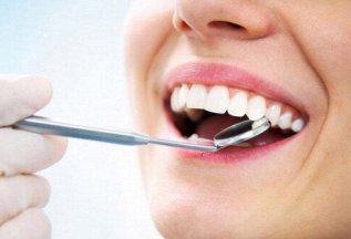 Скидка 20 % на профессиональную гигиену полости рта