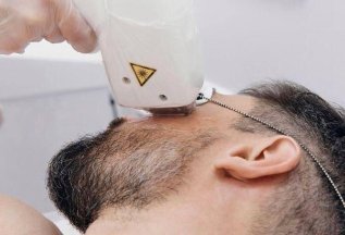 Лазерная эпиляция для мужчин от 1500 руб