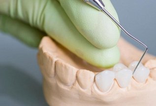 Протезирование зубов в клинике Семейный Стоматолог