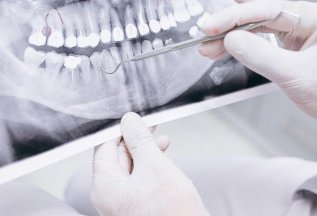 Консультация врача стоматолога бесплатно