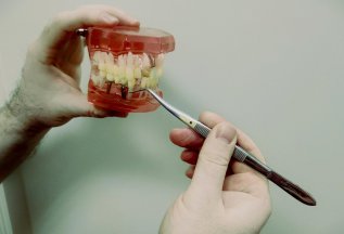Имплантация зубов со скидкой до 37%