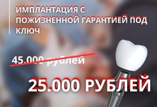 ИМПЛАНТ ПРЕМИУМ КЛАССА 25.000 ВМЕСТО 45.000 РУБЛЕЙ ПОД КЛЮЧ