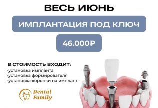 Имплантация зубов