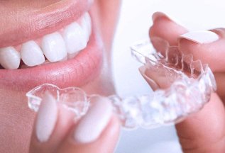 Ровные зубы без брекетов - ЭЛАЙНЕРЫ
