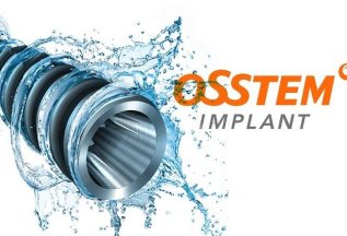 Имплантация Osstem + коронка «под ключ» со скидкой 10%