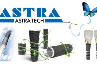 Имплантация Astra Tech + коронка «под ключ» со скидкой 10%