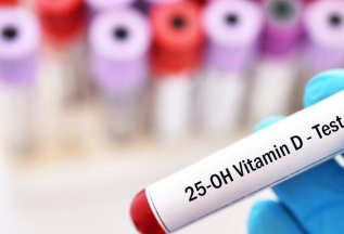 Анализ на витамин Д 25-ОН по рекордной цене