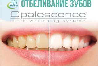 Отбеливание зубов Opalescence всего 14900 руб.