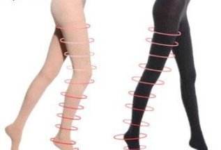 Компрессионные чулки в подарок при лечении варикоза ног