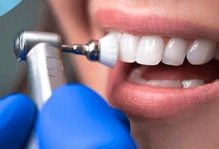 Профессиональная комплексная чистка зубов - 5500 руб.