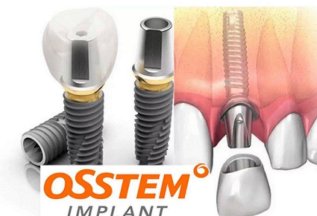 Установка имплантата Osstem с циркониевой коронкой за 45000