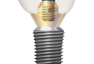 Установка имплантата Dentium с циркониевой коронкой за 60900