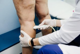 Акция! Комплексная диагностика варикоза со скидкой 50%