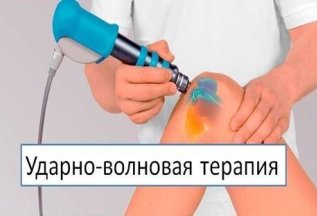 Ударно-волновая терапия