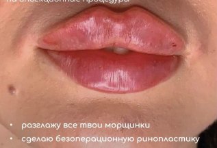 Дарю 2000 р. на первую процедуру