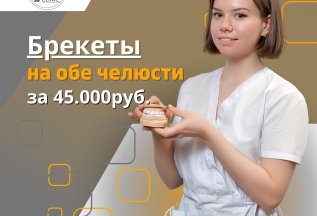 Установка брекет-системы на обе челюсти