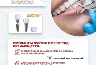 Имплантация Osstem