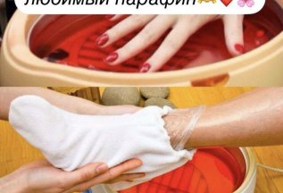Парафинотерапия